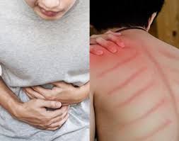 Beberapa-Cara-Mengatasi-Masuk-Angin-Tanpa-Menggunakan-Obat.